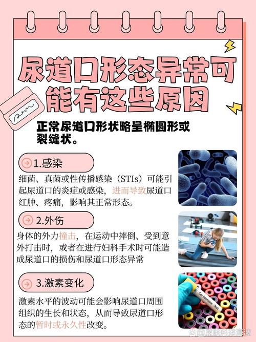 张柏芝大尺度照的相关介绍