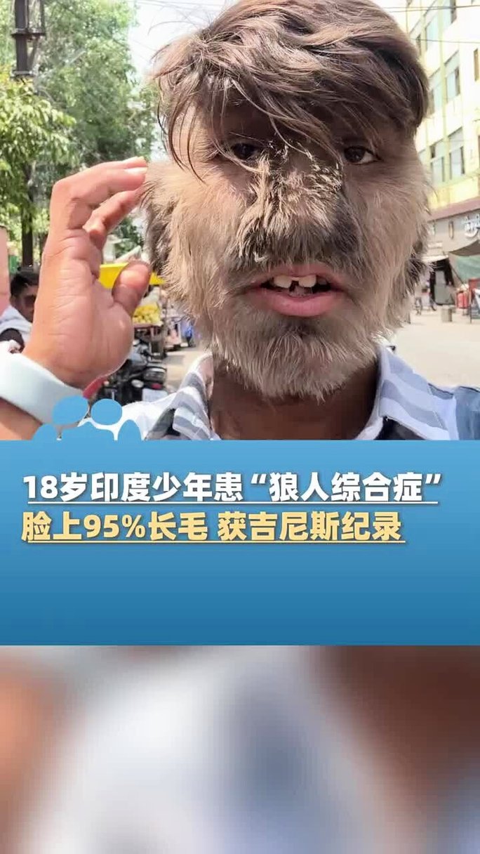人妻|91的相关介绍